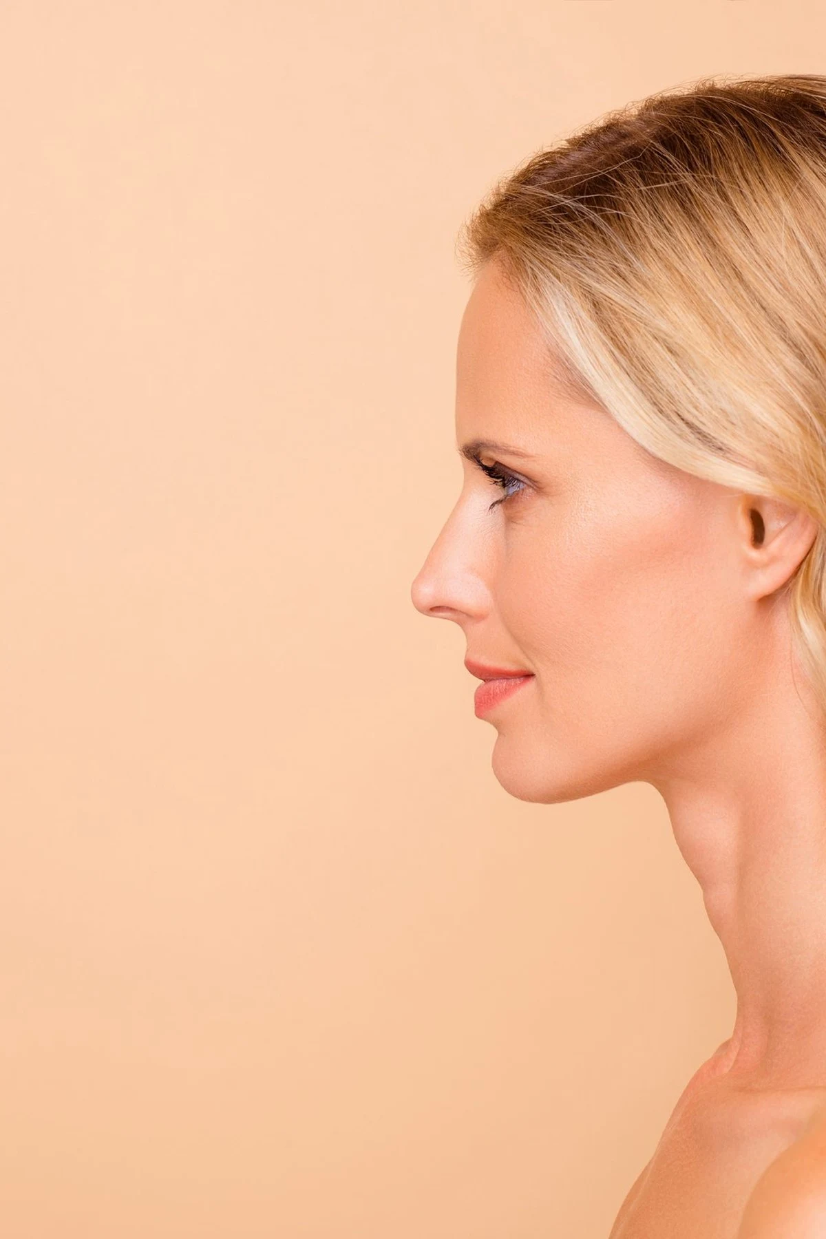 Perfiloplastia